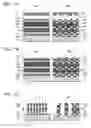 Fig. 08 - WAFER AND METHOD FOR MANUFACTURING MICROSCOPIC STRUCTURE ON WAFER