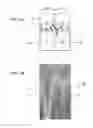 Fig. 03 - Solid-state imaging device, method of manufacturing the same, and electronic apparatus
