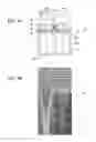 Fig. 08 - Solid-state imaging device, method of manufacturing the same, and electronic apparatus