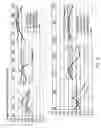 Fig. 14 - Mobile device having an interior multiband antenna and a partially metal back