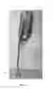 Fig. 09 - GPS/WiFi battery antenna