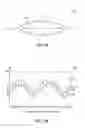 Fig. 02 - Determining feasibility of a network service using a ring analysis
