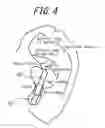 Fig. 05 - Acoustic device