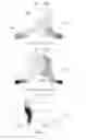 Fig. 10 - Horn apparatus