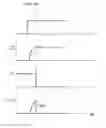 Fig. 04 - Systems and methods for reduction of audio artifacts in an audio system with dynamic range enhancement