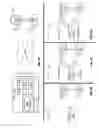 Fig. 04 - Clear channel assessment (CCA) levels within wireless communications