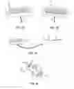 Fig. 05 - Aquarium bacteria management device