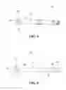 Fig. 07 - MASTECTOMY BRA ACCESSORY DEVICE