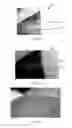 Fig. 07 - WIG AND METHOD OF WIG MANUFACTURE