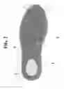 Fig. 03 - BI-MATERIAL SHOE BOTTOM WITH FOAM INSERT