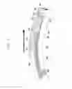 Fig. 11 - Buckle apparatus for wearable device