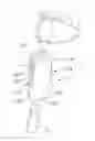 Fig. 01 - APPLICATOR DEVICE