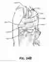 Fig. 44 - Load bearing suspension system