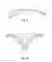Fig. 07 - Edge structure for body support surface
