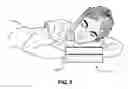 Fig. 06 - Flexible pillow device