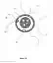 Fig. 14 - Endoscope accessory