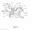 Fig. 32 - Endoscope accessory