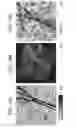 Fig. 15 - METHOD OF PHOTOACOUSTIC MICROSCOPY WITH LATERAL RESOLUTION OF MICROVASCULATURE