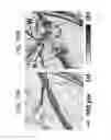 Fig. 16 - METHOD OF PHOTOACOUSTIC MICROSCOPY WITH LATERAL RESOLUTION OF MICROVASCULATURE