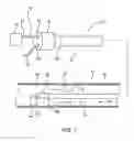 Fig. 02 - Microcatheter sensor design for minimizing profile and impact of wire strain on sensor