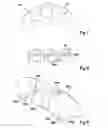Fig. 06 - Implantable Electrode Lead
