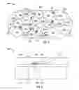 Fig. 03 - Nerve interface electrode with fibers for insertion between nerve fascicles