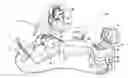 Fig. 01 - Catheter with combined position and pressure sensing structures