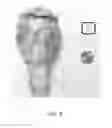 Fig. 04 - System and method for laryngeal reflex examination