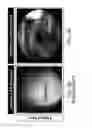Fig. 05 - System and method for laryngeal reflex examination
