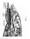 Fig. 07 - System and method for laryngeal reflex examination