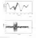 Fig. 02 - Method for detecting a malfunction of a sensor for measuring an analyte concentration in vivo