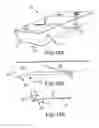 Fig. 05 - X-ray mammography and/or breast tomosynthesis using a compression paddle