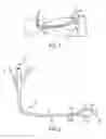Fig. 02 - Coaptation ultrasound devices and methods of use