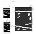 Fig. 09 - System and method for non-invasive determination of human body fat