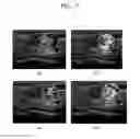 Fig. 08 - Method and apparatus for generating ultrasound image