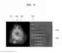 Fig. 09 - Method and apparatus for generating ultrasound image