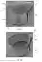 Fig. 04 - MEDICAL SPECIMEN COLLECTION SYSTEM