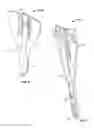 Fig. 04 - Surgical access system and related methods