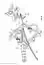 Fig. 10 - Surgical access system and related methods
