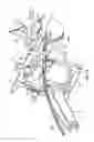 Fig. 11 - Surgical access system and related methods