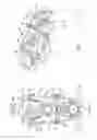 Fig. 02 - Tissue retractor and method of use