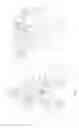 Fig. 03 - Tissue retractor and method of use