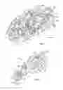 Fig. 04 - Tissue retractor and method of use