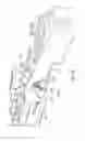 Fig. 08 - Tissue retractor and method of use