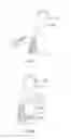 Fig. 14 - Tissue retractor and method of use