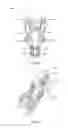 Fig. 16 - Tissue retractor and method of use