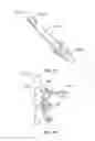 Fig. 18 - Tissue retractor and method of use