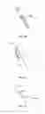Fig. 22 - Tissue retractor and method of use