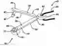 Fig. 01 - Method and means to attach anchor suture onto mesh implants