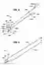 Fig. 06 - Method and means to attach anchor suture onto mesh implants